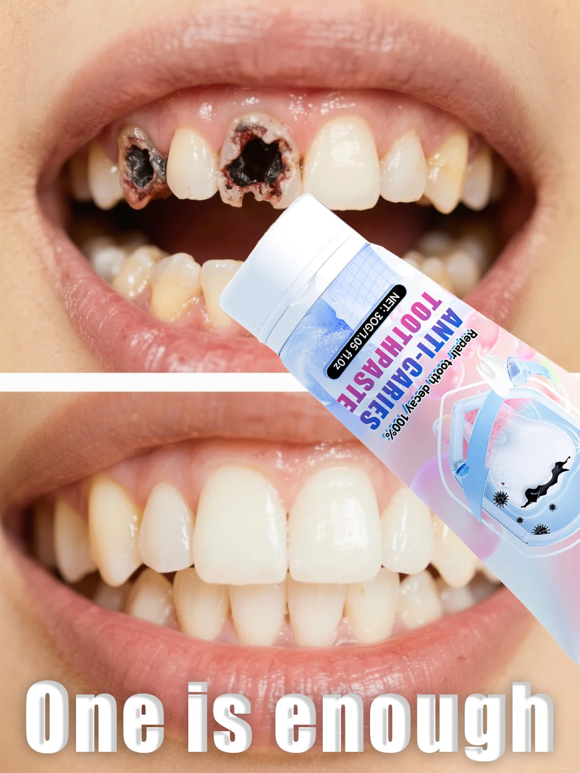 Teeth Whitening Charcoal Powder - ⁹⁹% ของคนทั่วไป ใช้การดูแลเหงือกเพื่อฟื้นฟูอาการเหงือกอักเสบ ลมหายใจหอมสดชื่น