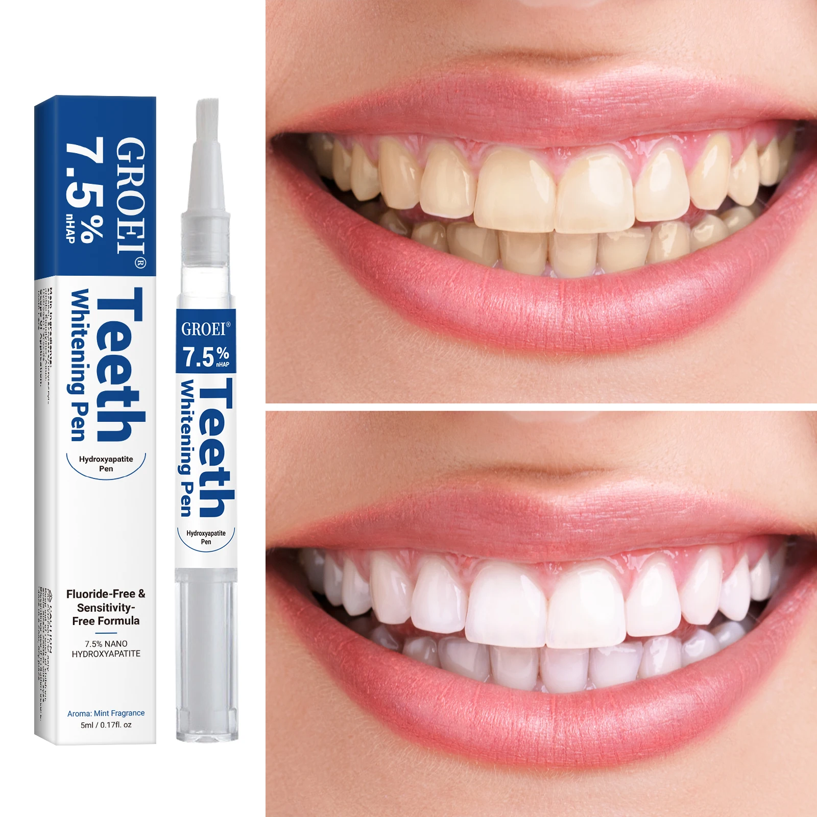 ปากกาฟอกสีฟันไฮดรอกซีอะพาไทต์  - Teeth Whitening Groupon บทวิจารณ์และราคา