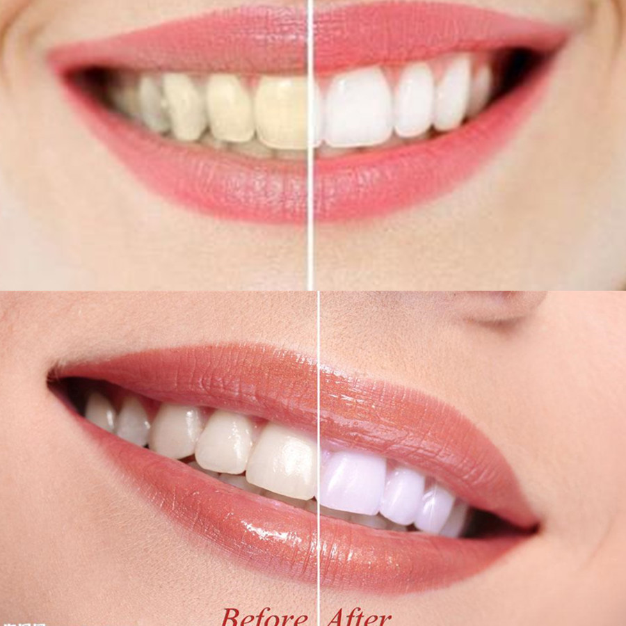 ถ่านไม้ไผ่ฟันฟันทันตกรรมสูตร L - Teeth Whitening Charcoal Powder บทวิจารณ์และราคา