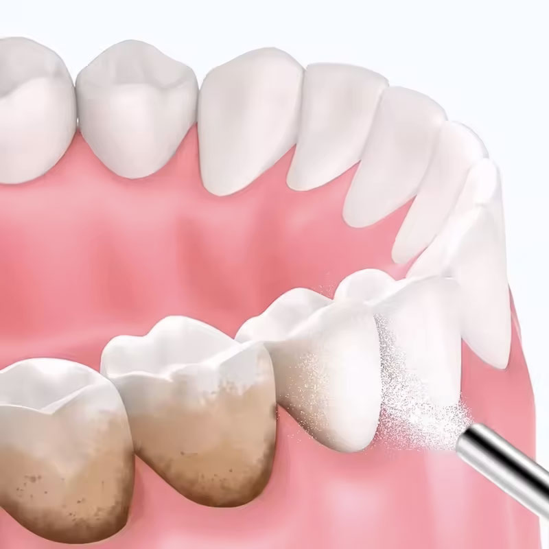 ผงทรายขัดฟัน 130 กรัม ผงฟอกสีฟ - Teeth Whitening Zimba บทวิจารณ์และราคา