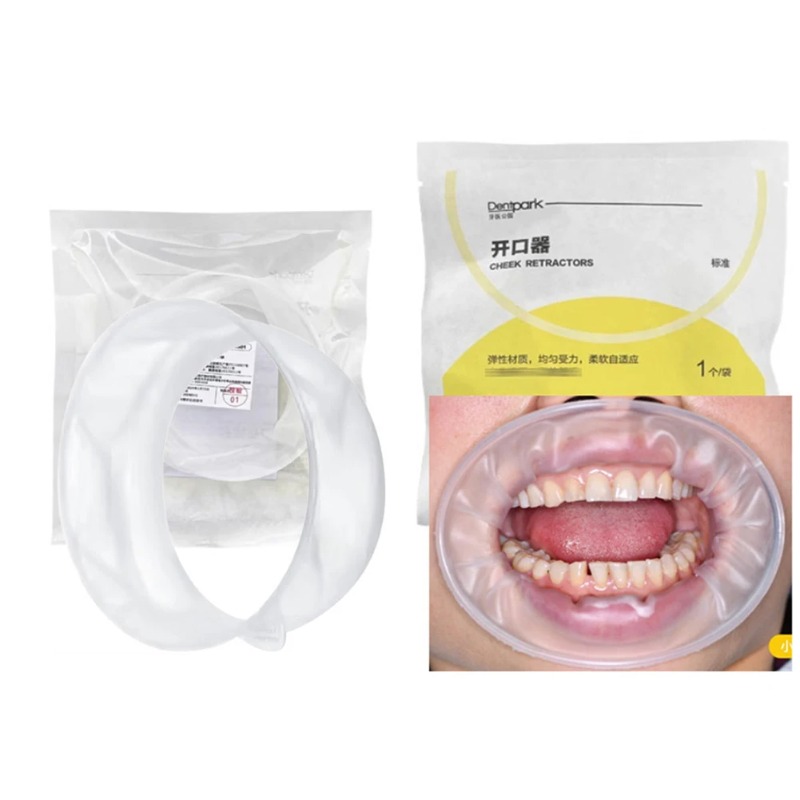 20 ชิ้น Dentpark อุปกรณ์ถ่างปา - Teeth Whitening Clinic บทวิจารณ์และราคา
