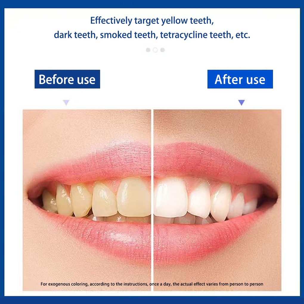 แปรงสีฟันถ่าน5D ขาว70/140คู่แผ - Teeth Whitening Effects บทวิจารณ์และราคา