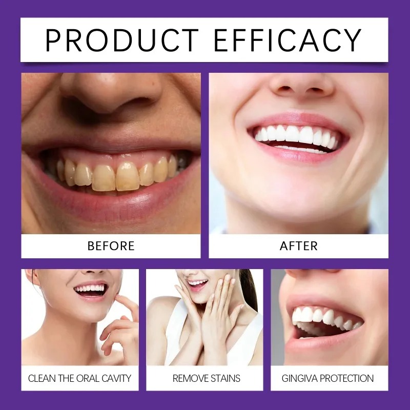 ผงแร่ฟื้นฟูฟันสีม่วง ผงยาสีฟัน - Teeth Whitening Zimba บทวิจารณ์และราคา